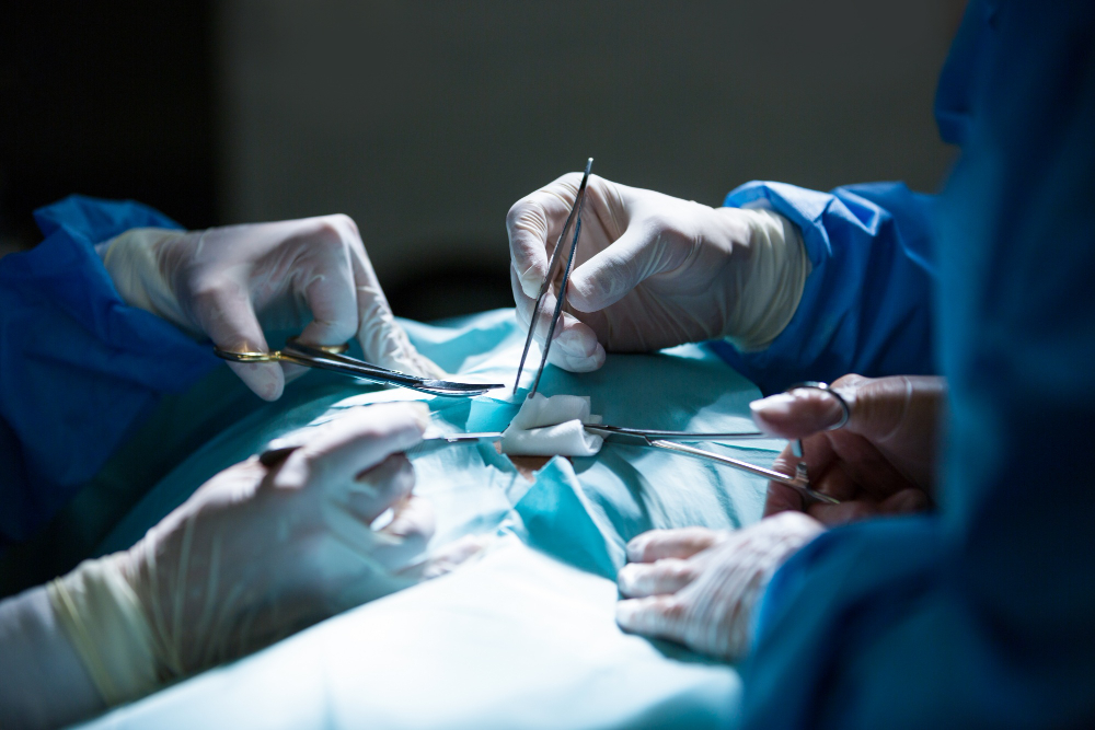 Hernia Surgery in Hanamkonda